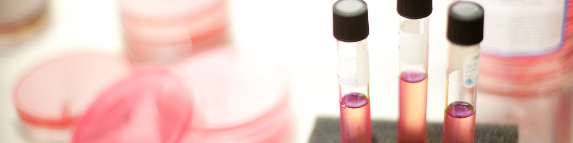 Samples in the Cascade Medical laboratory.