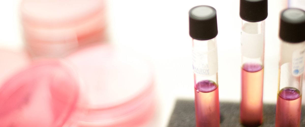 Samples in the Cascade Medical laboratory.